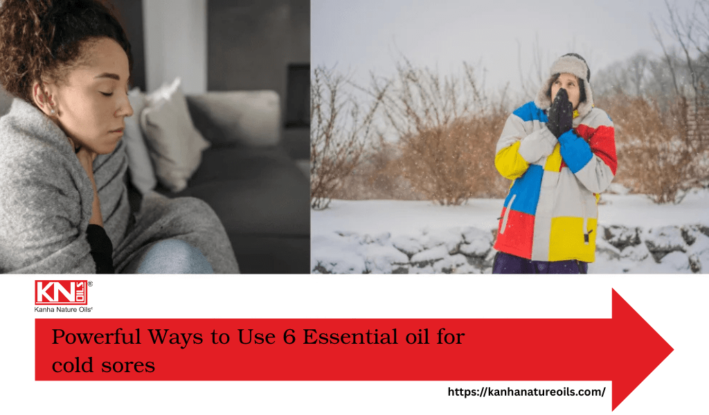 Powerful Ways to Use 6 Essential oil for cold sores