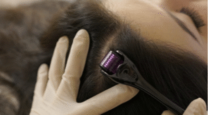 Strengthens Hair Follicles